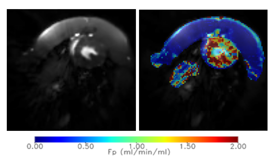 Myocardial perfusion